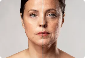 best Anti-Aging Treatment 